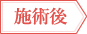 施術後